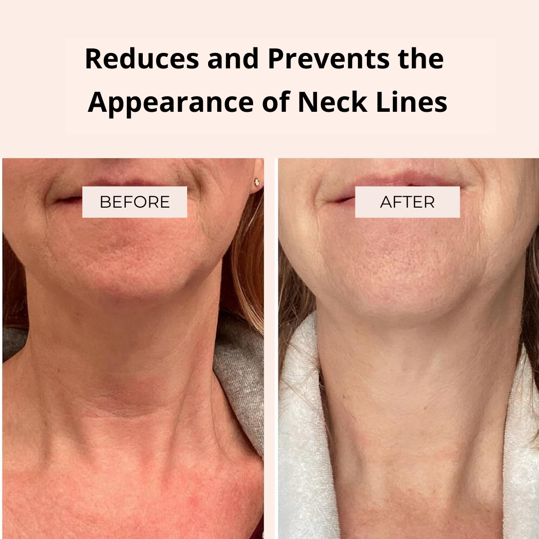 Neck Wrinkles Patch